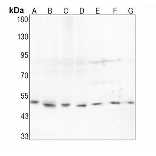 PTP1B Rabbit Monoclonal Antibody(C1617)