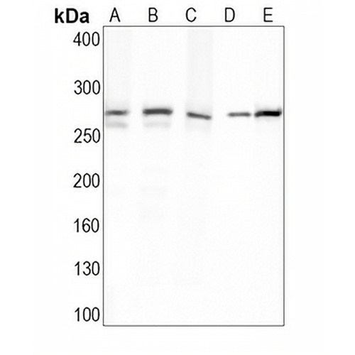 FASN Rabbit Monoclonal Antibody(C1618)