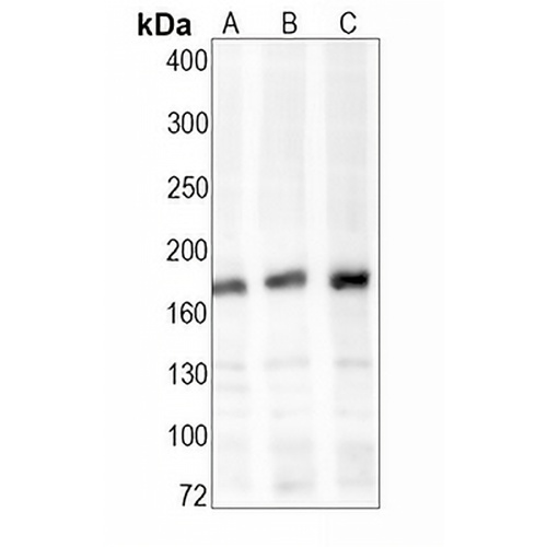 CD206 Rabbit Monoclonal Antibody(C1619)
