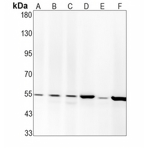 Parkin Rabbit Monoclonal Antibody(C1620)
