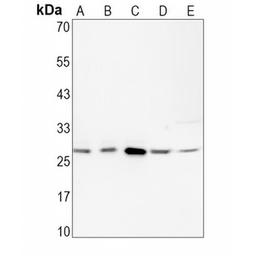 BCL2 Rabbit Monoclonal Antibody(C1621)