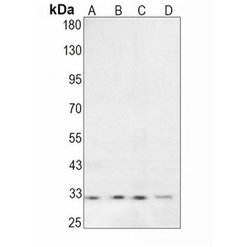 BNIP3 Rabbit Monoclonal Antibody(C1622)