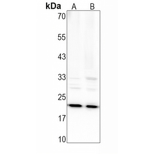 BID Rabbit Monoclonal Antibody(C1623)
