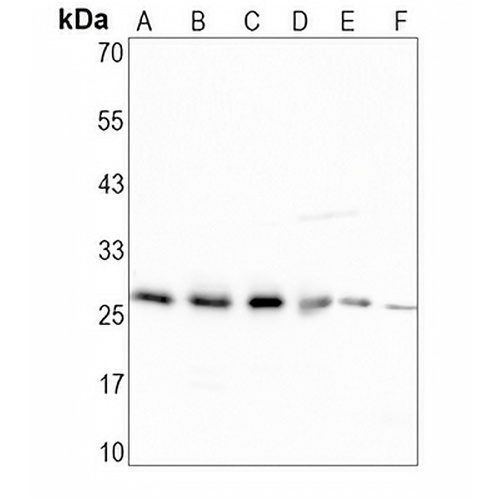 BNIP1 Rabbit Monoclonal Antibody(C1626)