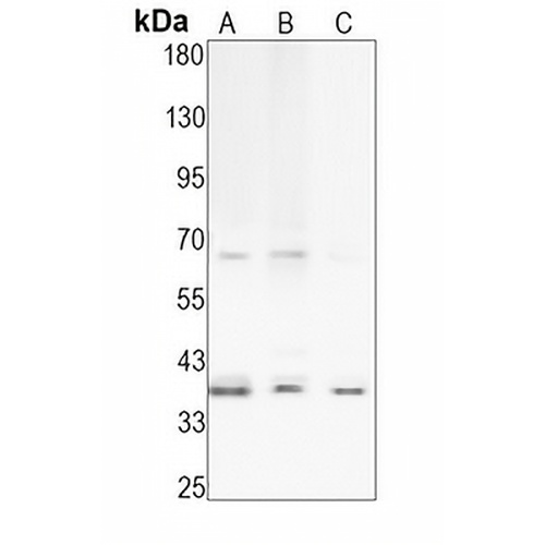 BNIP3L Rabbit Monoclonal Antibody(C1627)