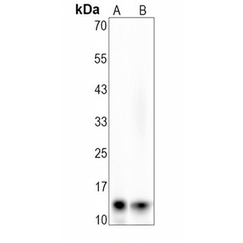 CXCL4 Rabbit Monoclonal Antibody(C1629)