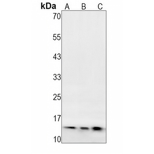 GEF2 Rabbit Monoclonal Antibody(C1631)
