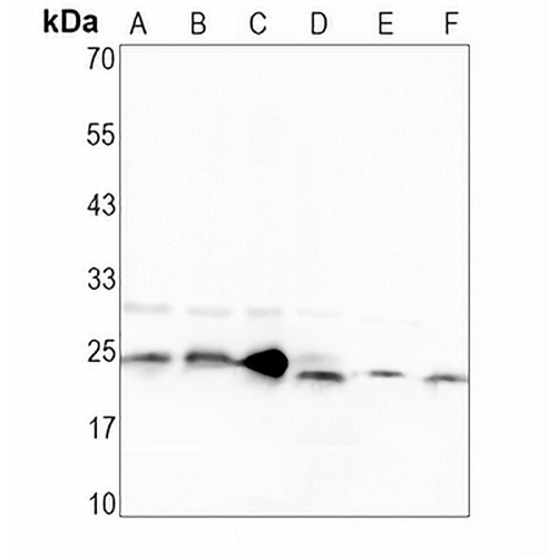 TCF6 Rabbit Monoclonal Antibody(C1632)