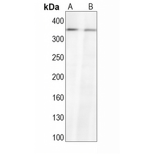 ATM Rabbit Monoclonal Antibody(C1633)