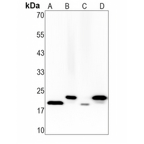 FNDC5 Rabbit Monoclonal Antibody(C1635)