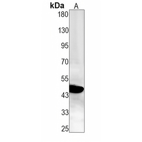 p47 phox Rabbit Monoclonal Antibody(C1636)