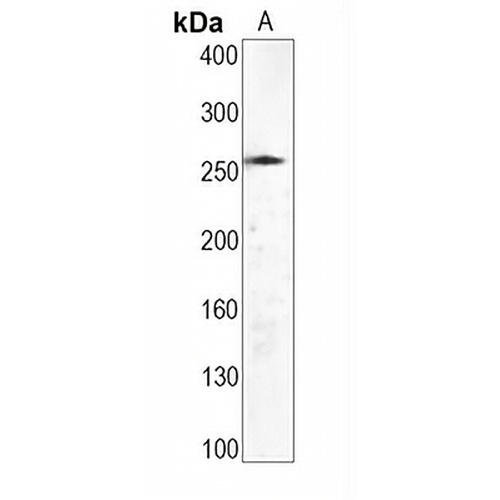 WNK1 Rabbit Monoclonal Antibody(C1638)