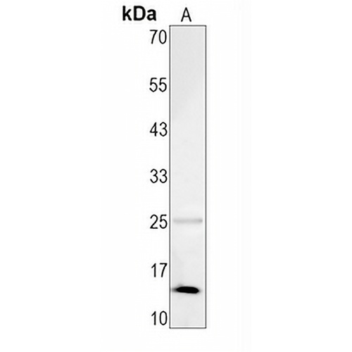 CRABP1 Rabbit Monoclonal Antibody(C1640)