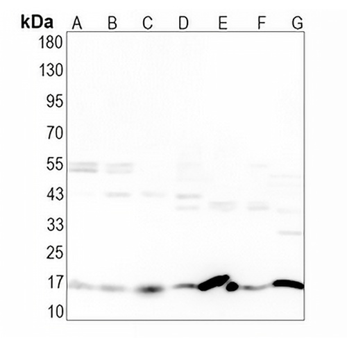 Fis1 Rabbit Monoclonal Antibody(C1641)