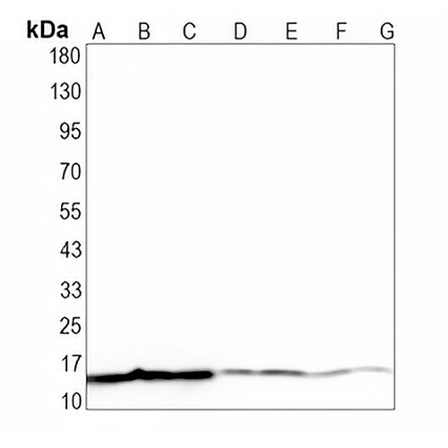 PLA2G2A Rabbit Monoclonal Antibody(C1642)