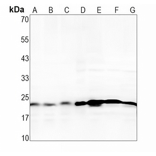 Glyoxalase I Rabbit Monoclonal Antibody(C1643)