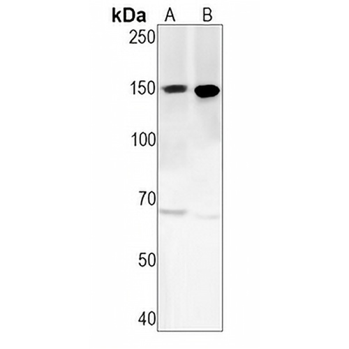 PLC beta 3 Rabbit Monoclonal Antibody(C1644)