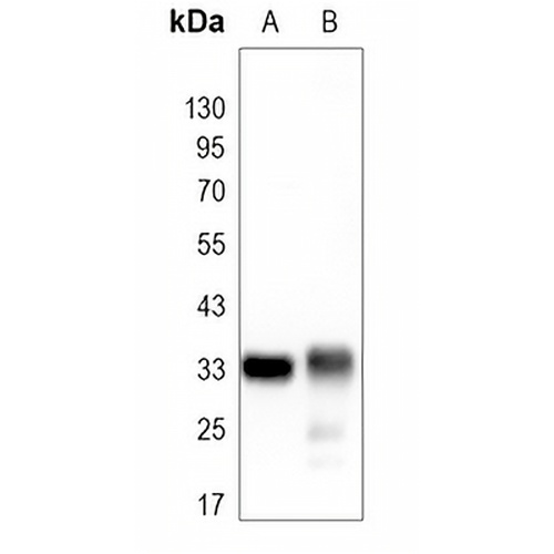 CDK4 Rabbit Monoclonal Antibody(C1645)