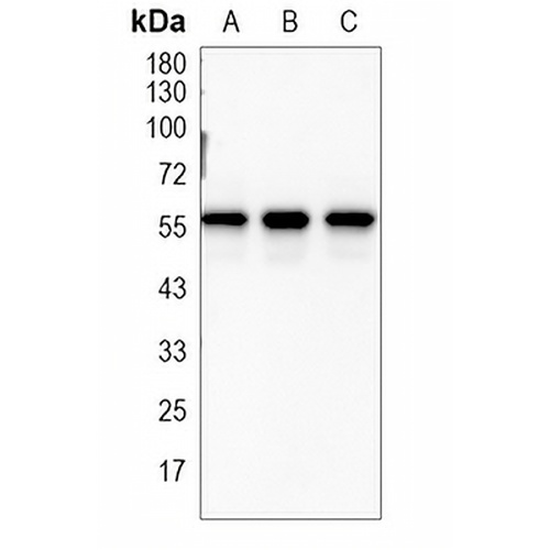 Pyruvate Kinase Rabbit Monoclonal Antibody(C1648)