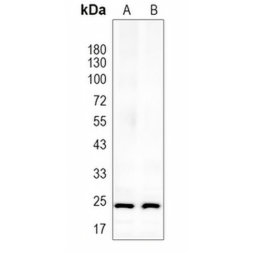 IFN gamma Rabbit Monoclonal Antibody(C1649)