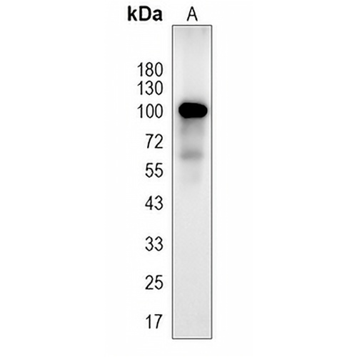 Fibrinogen alpha Rabbit Monoclonal Antibody(C1650)