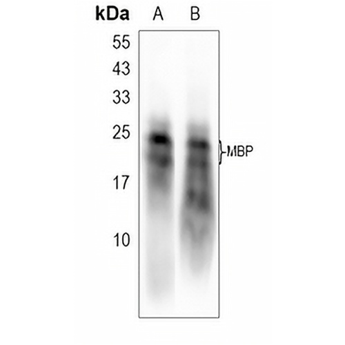 MBP Rabbit Monoclonal Antibody(C1651)