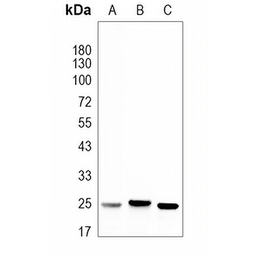 EIF4E (Phospho-S209) Rabbit Monoclonal Antibody(C1652)