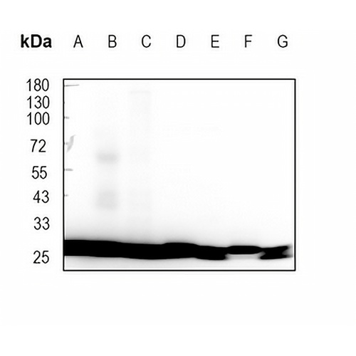 RPL7A Rabbit Monoclonal Antibody(C1654)