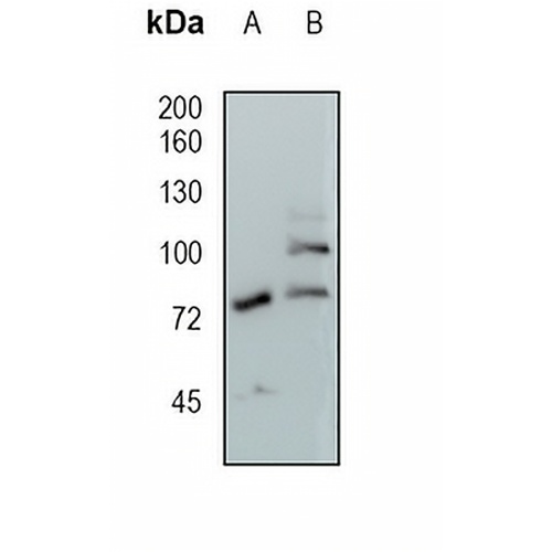 GAA Rabbit Monoclonal Antibody(C1655)