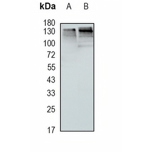 HTATSF1 Rabbit Monoclonal Antibody(C1656)