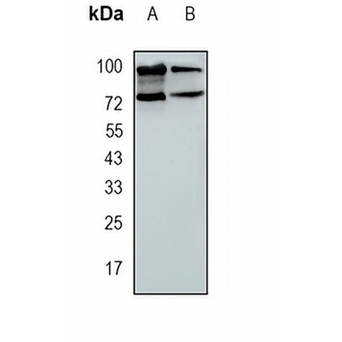 ERCC2 Rabbit Monoclonal Antibody(C1657)