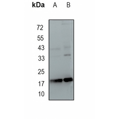 CIRBP Rabbit Monoclonal Antibody(C1658)