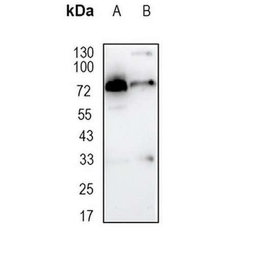 TRMT2A Rabbit Monoclonal Antibody(C1660)