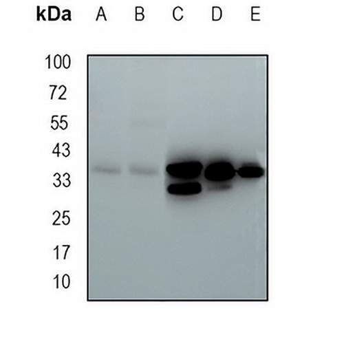 QKI Rabbit Monoclonal Antibody(C1661)