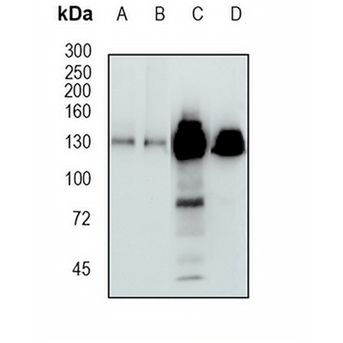 UBE4B Rabbit Monoclonal Antibody(C1662)
