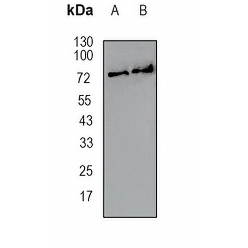 CARS Rabbit Monoclonal Antibody(C1663)