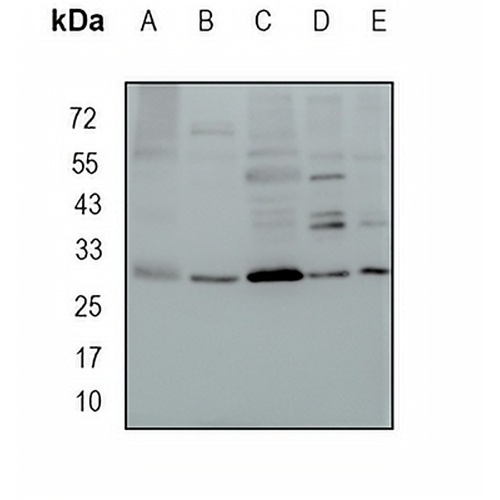 MRPL28 Rabbit Monoclonal Antibody(C1664)