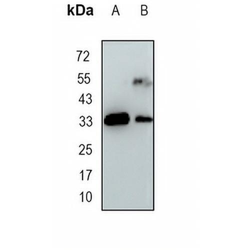 UPase 1 Rabbit Monoclonal Antibody(C1668)
