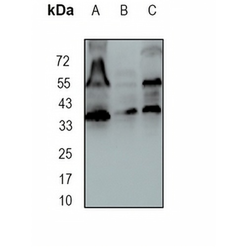 HDGF Rabbit Monoclonal Antibody(C1669)