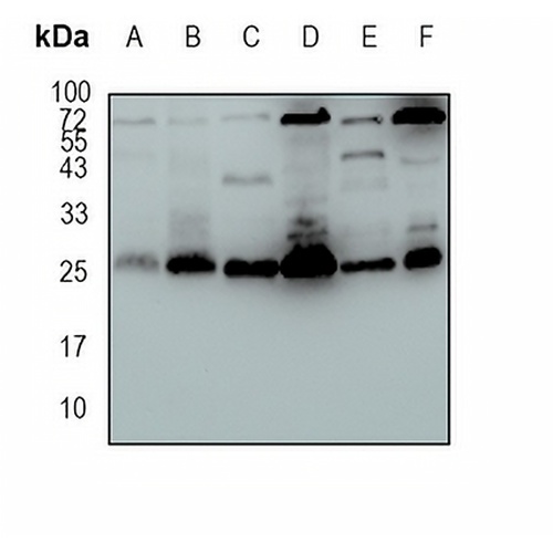 SLC31A1 Rabbit Monoclonal Antibody(C1670)
