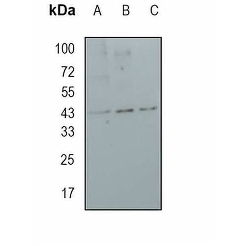 MVD Rabbit Monoclonal Antibody(C1672)