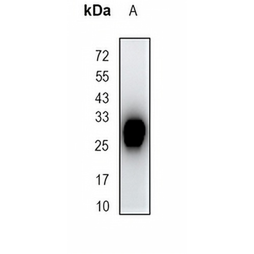 HLA-DMB Rabbit Monoclonal Antibody(C1674)