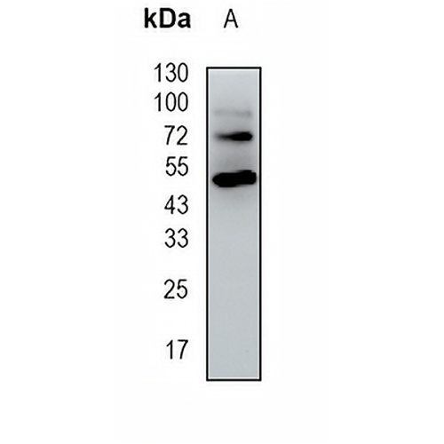 HGD Rabbit Monoclonal Antibody(C1675)