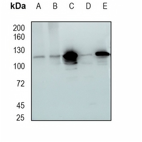 RASA1 Rabbit Monoclonal Antibody(C1676)