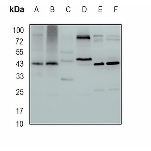 CD336 Rabbit Monoclonal Antibody(C1677)