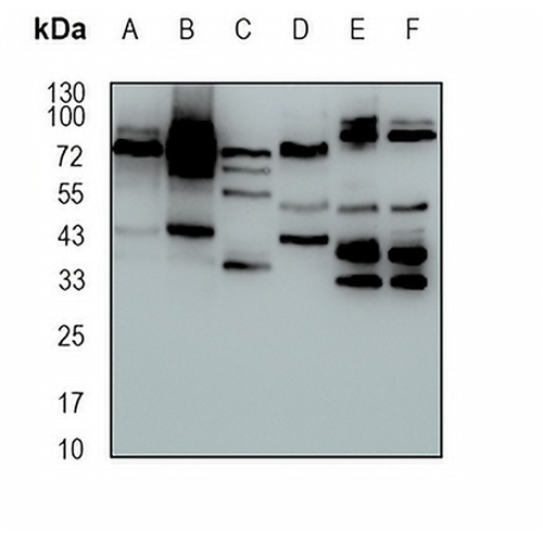 CLPTM1 Rabbit Monoclonal Antibody(C1680)