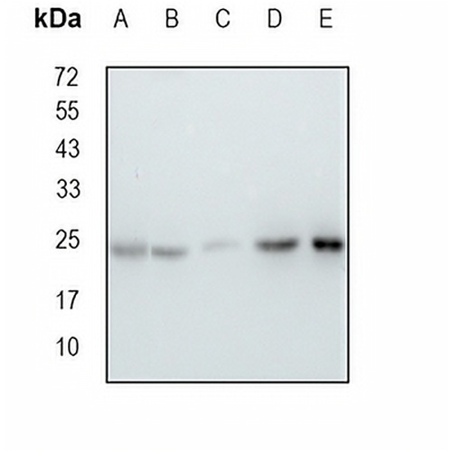 RPL13 Rabbit Monoclonal Antibody(C1683)
