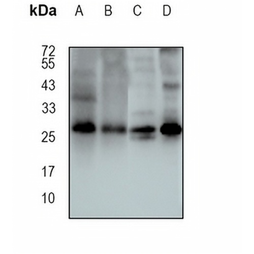SNAP29 Rabbit Monoclonal Antibody(C1684)