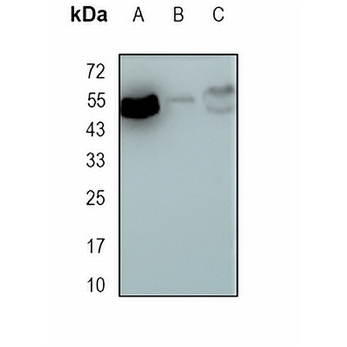 MEF2A Rabbit Monoclonal Antibody(C1685)