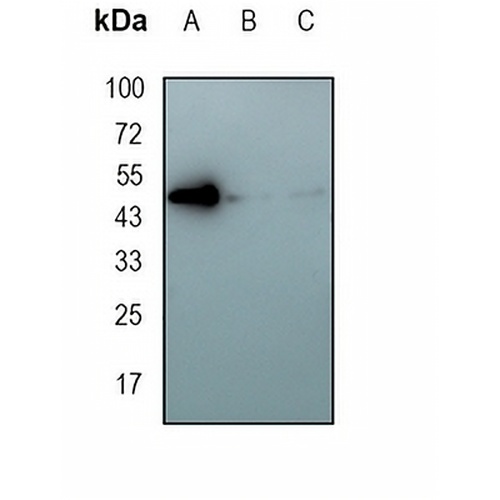 JNK1 Rabbit Monoclonal Antibody(C1686)